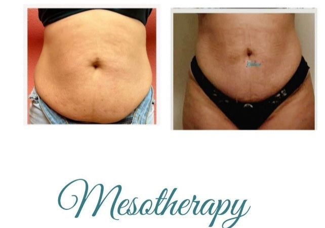 Lipo Dissolve