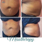 Lipo Dissolve